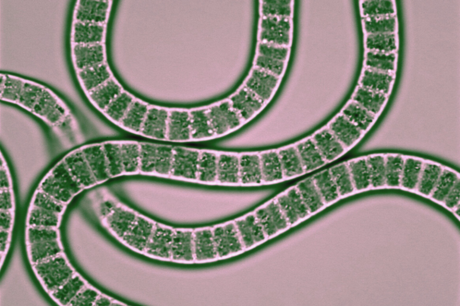 Beyond the lung: treating the GI symptoms of Covid-19