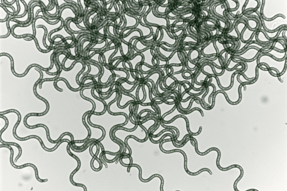 Q and A with Lumen: using spirulina to manufacture Covid-19 antibodies
